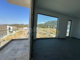 GİRNE / ÇATALKÖY – EFSANE KONUMDA, ARSA FİYATINA LÜKS VİLLA FIRSATI/+905338610484